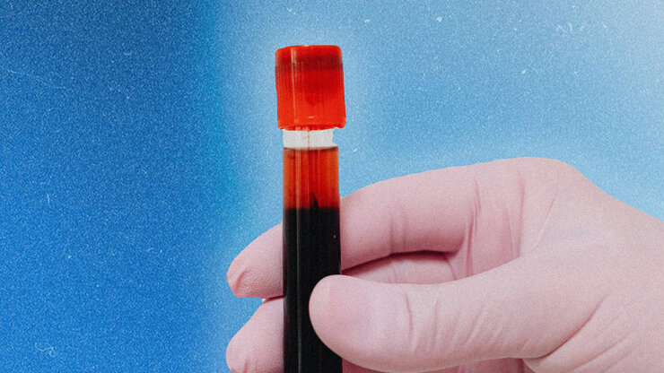 New breakthrough in HIV treatment brings researchers closer to a possible cure